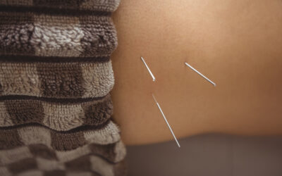 Acupuncture: Insomnia and Better Sleep